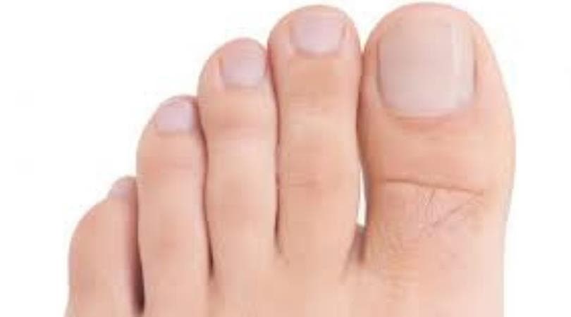 ¿Cómo debemos de cortar las uñas de los pies? ¿Corte recto o redondeado?