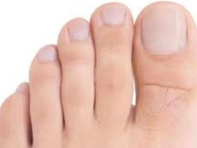 ¿Cómo debemos de cortar las uñas de los pies? ¿Corte recto o redondeado?