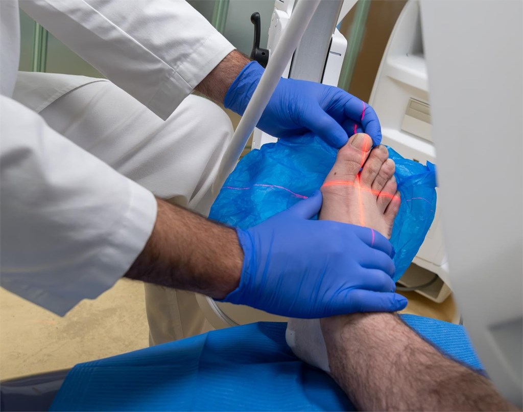 ¿Cómo saber si puedes someterte a una cirugía del pie?
