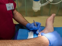 ¿Cuál es el mejor remedio para los callos de los pies?