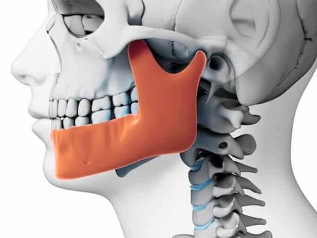 Dolores de cabeza, de cuello, mareos... alteraciones en la articulación temporomandibular