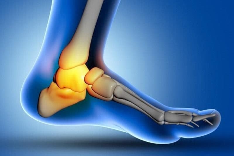 Esguince de tobillo: ¿puede provocarse por una mala pisada?