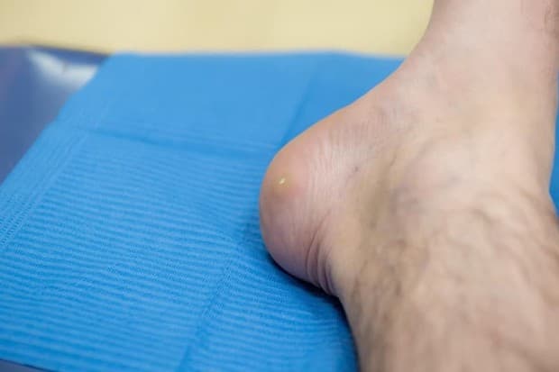 Podología en Clínica Teknos