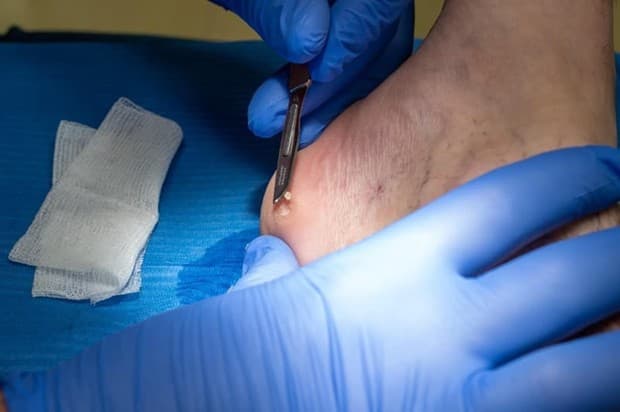 Podología en Clínica Teknos