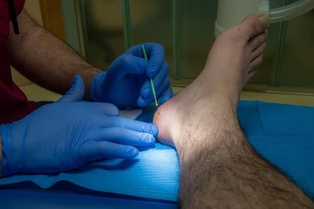 Podología en Clínica Teknos
