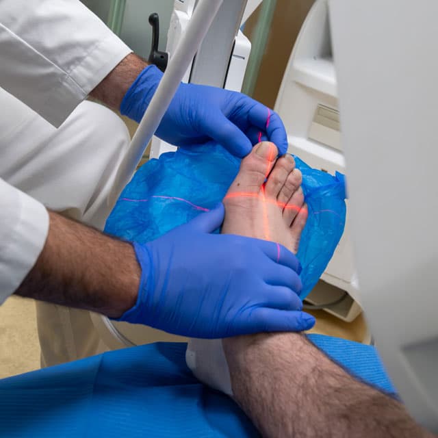 Servicio de podología, cirugía del pie y biomecánica en Ourense