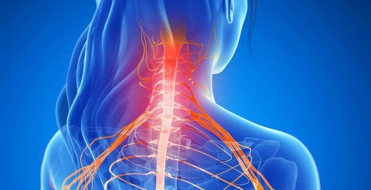 La importancia de la Fisioterapia en el tratamiento del Síndrome Cervicobraquial