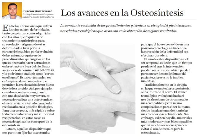 Los avances en la Osteosíntesis